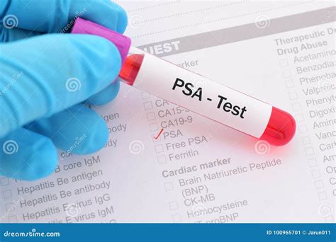 Psa Test Stock Image Image Of Scientific Hospital 100965701