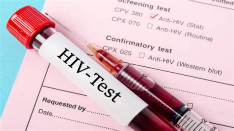Cost Effective Hiv Treatment Drug Recommended By Who The Hindu