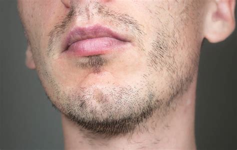 Kein Bartwuchs Wie Das Problem Angehen Heisenbeard