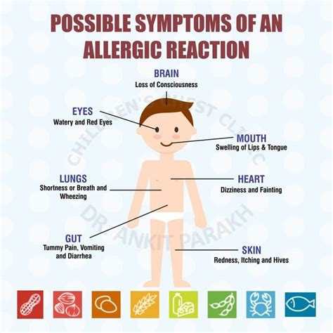 Allergies Dr Ankit Parakh