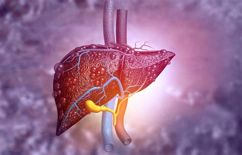 Trio Of Immune Cells Critical For Liver Cancer Immunotherapy