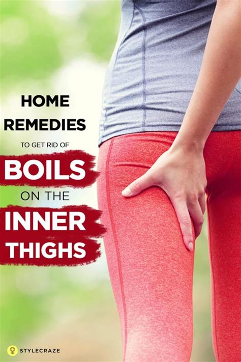 12 Home Remedies To Get Rid Of Boils On The Inner Thighs Get Rid Of
