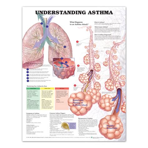 111 best asthma images asthma asthma remedies asthma relief. Inhaler Colors Chart : We configure our charts according ...