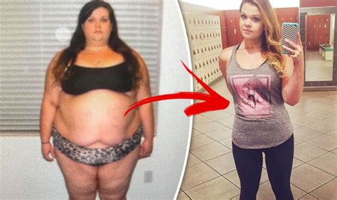Obese Woman Shed Stone After Weight Loss Surgery But Then Her