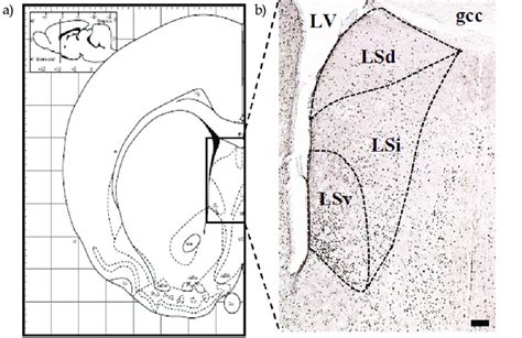 Lateral Septal Nucleus A Black Rectangle Indicates The Lsn Adapted