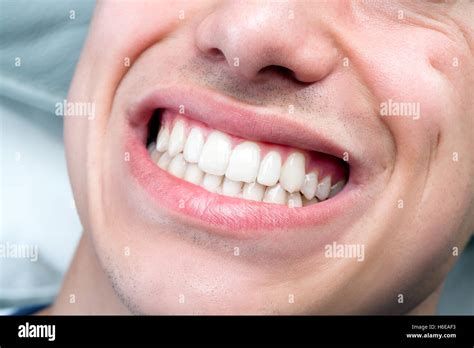 Macro Close Up Of Human Male Mouth Showing Perfect White Teeth Stock