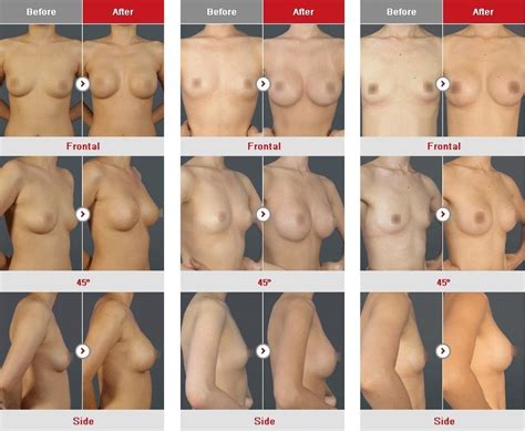 Nude Cup Size Comparison Mega Porn Pics My Xxx Hot Girl