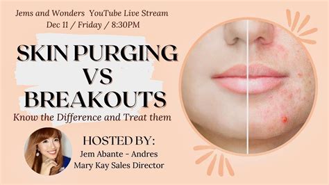 Skin Purging Vs Breakouts Know The Difference And Effective Skin Care