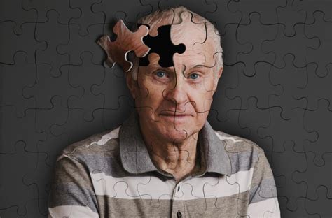 Diagnozowanie I Leczenie Choroby Alzheimera Pomoc Geriatry 33872 Hot Sex Picture