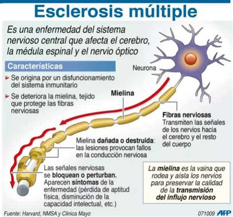 La esclerosis multiple (em) es una enfermedad autoinmunitaria que afecta el cerebro y la médula espinal (sistema nervioso central). Esclerosis Múltiple: qué es, síntomas y tipos - Demedicina.com