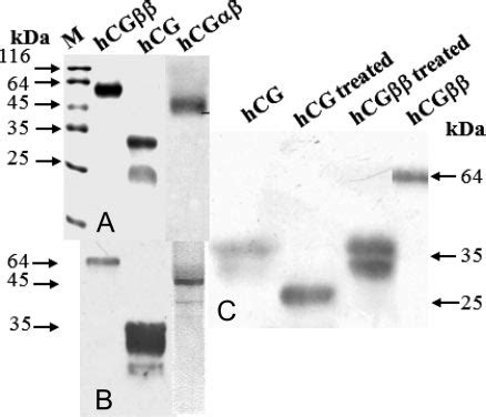 SDS PAGE And Western Blot Of HCG And HCG A Equal Amounts Of Proteins