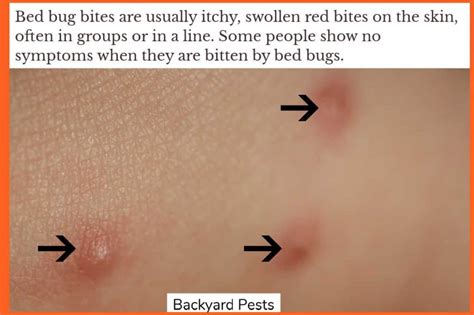 7 Signs Of Bed Bugs With Pictures And Video Backyard Pests