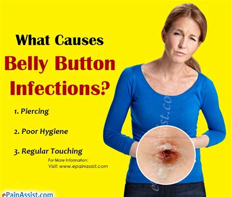 Rash Inside Belly Button
