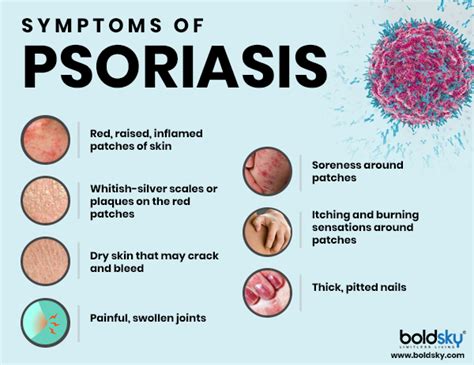 Biologics What Are They And How They Help Treat Psoriasis