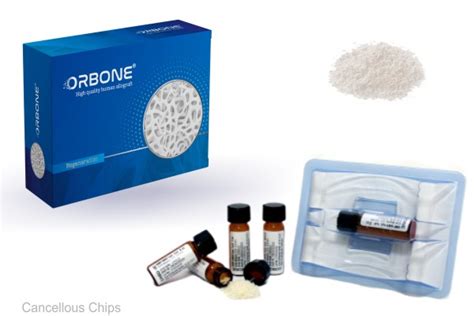 Cancellous Chips Orbone Cell And Tissue Bank
