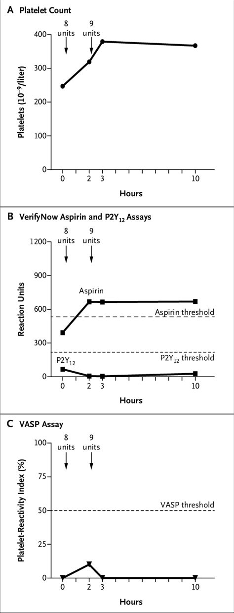 Platelet Monitoring During Platelet Transfusion Platelet Transfusion