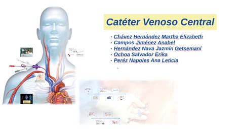 Hipótesis Atento Aprovechar Cateter Venoso Central Distal Proximal