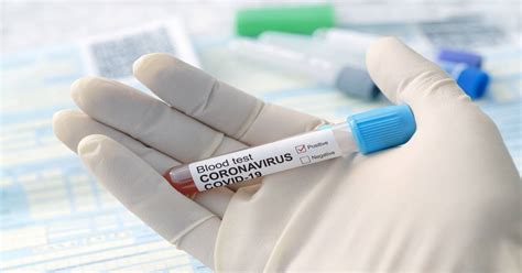 It was first identified in december 2019 in wuhan,. Emergency COVID-19 Sick Leave Bill Signed into Congress