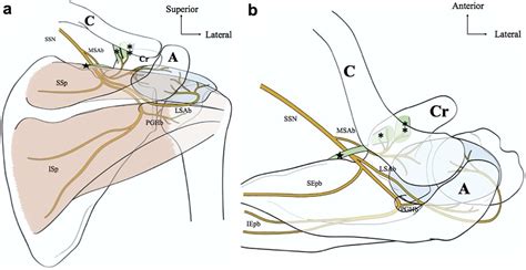 The Use Of Suprascapular Nerve Block Injection For People With Chronic