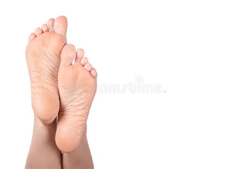cracked heel on woman foot female feet turned up dry heels and soles woman on white background