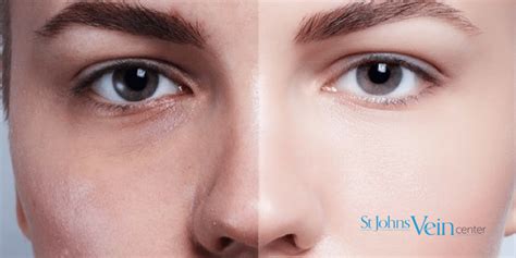 Skin Discoloration Treatments Now Available