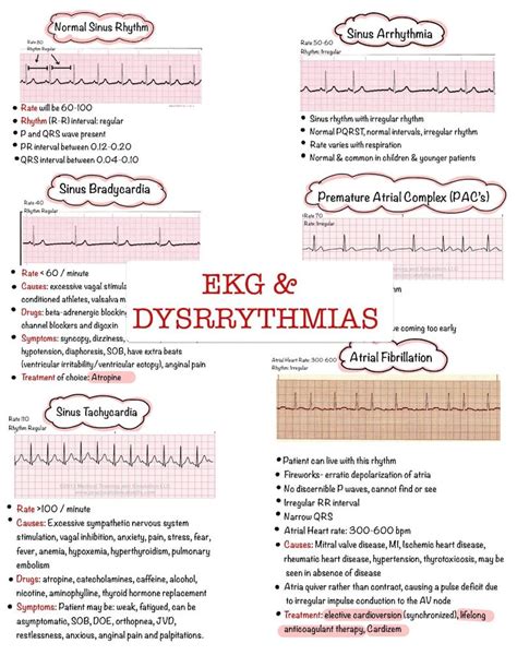 Basic Ekg Dysrhythmias And Interpretation Nursing Notes 6 Etsy Canada