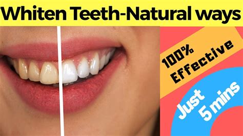 3 Ways To Whiten Your Teeth Naturally Stops And Prevents Bleeding