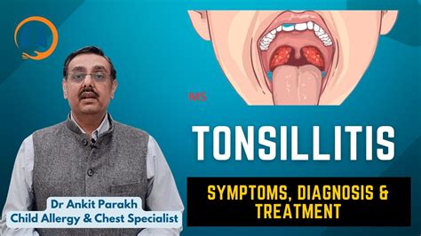 Tonsillitis In Children Symptoms Diagnosis And Treatment I Dr Ankit