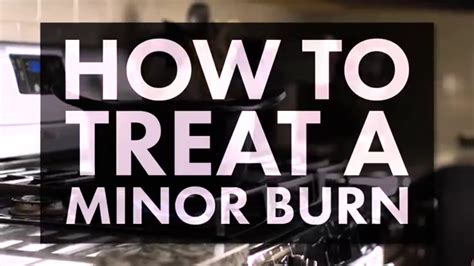 How to treat rope burn. How to Treat a Minor Burn - YouTube