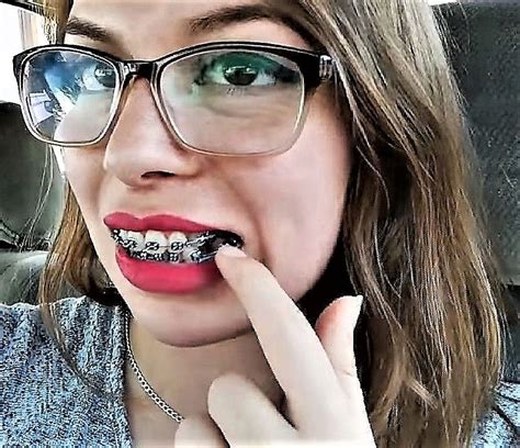 pin by maestro garcia on quick saves dental braces braces and glasses cute braces