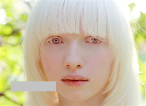 Elf Princess Mutation Too Beautiful Albino Girl Nascha Story Viewer