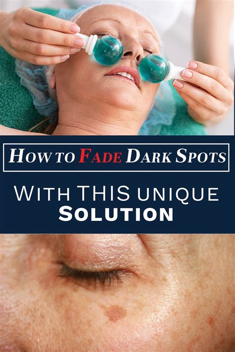 How To Fade Dark Spots Naturally Fade Dark Spots How To Fade Dark Spots