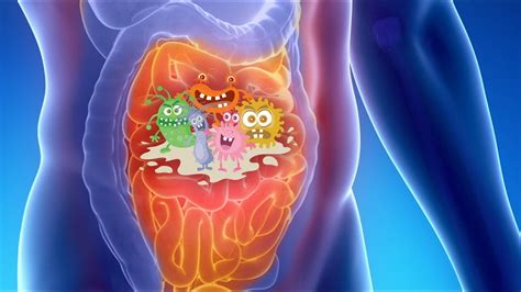 Small Intestinal Bacterial Overgrowth Updates And Clinical