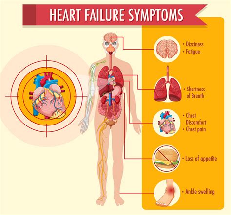 Congestive Heart Failure East Cardiovascular Specialists