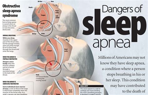 side effects of obstructive sleep apnea