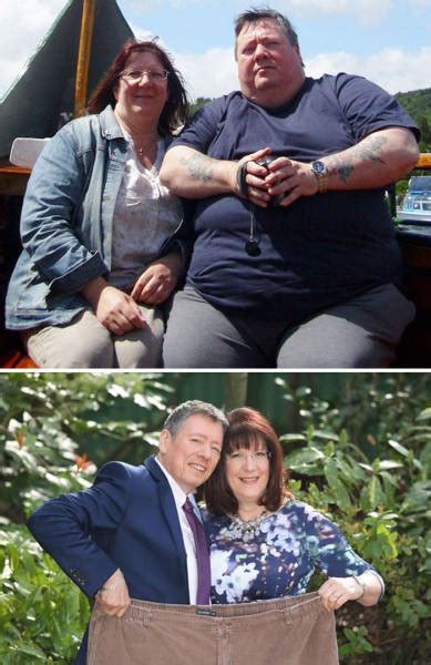 Before Vs After Photos Of Couples Who Lost Weight Together 51 Pics