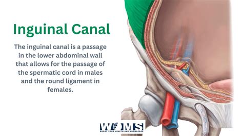 Inguinal Canal Anatomy And Important Clinical Conditions Woms