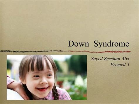 Ppt Down Syndrome Powerpoint Presentation Free Download Id3940066