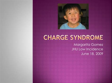 Ppt Charge Syndrome Powerpoint Presentation Id1838969