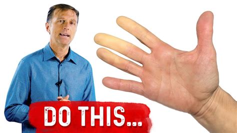 Raynauds Syndrome What Can You Do For Raynauds Syndrome Drberg Youtube