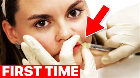 Women Get Lip Injections For The First Time Surgeon Reacts GentNews