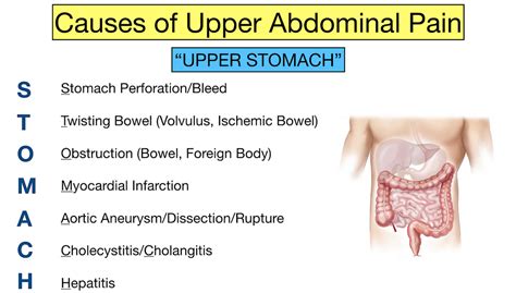 Abdominal Pain Causes The Upper Stomach Trick And Examples — Ezmed