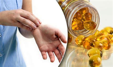 Fish Oil Is Key To Clearing Eczema Uk