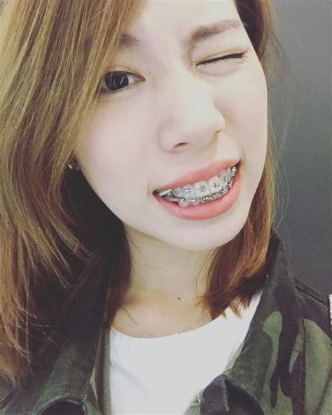 Pin By Shrood Burgos On Braces Cute Braces Braces Girls Perfect Teeth