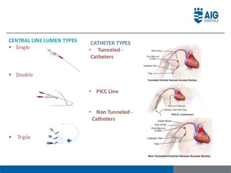 Picc Line Distal And Proximal
