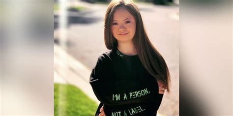 Meet Kennedy Garcia A Model With Down Syndrome