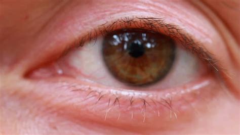 Close Up Of A Tired Red Eye Stock Footage Video 1162570 Shutterstock