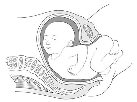 Présentation du siège Guides médicaux MSF