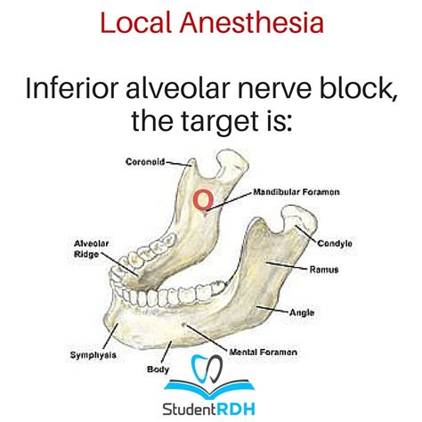 When Providing An Inferior Alveolar Nerve Block The Solution Should Be