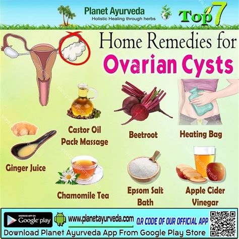 Ovarian Cysts Formed As A Result Of Menstrual Cycle Most Of Cysts Are